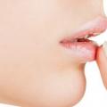 Какво да направите, ако устната ви се спука: съвети за възрастни и деца
