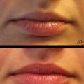 छोटे होठों के लिए शेडिंग टैटू के साथ स्थायी होंठ मेकअप की विशेषताएं
