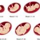 Zakaj se gestacijska starost glede na ultrazvok razlikuje od porodniške?